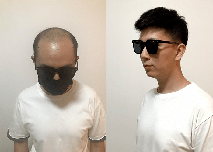 年轻人带假发合适吗