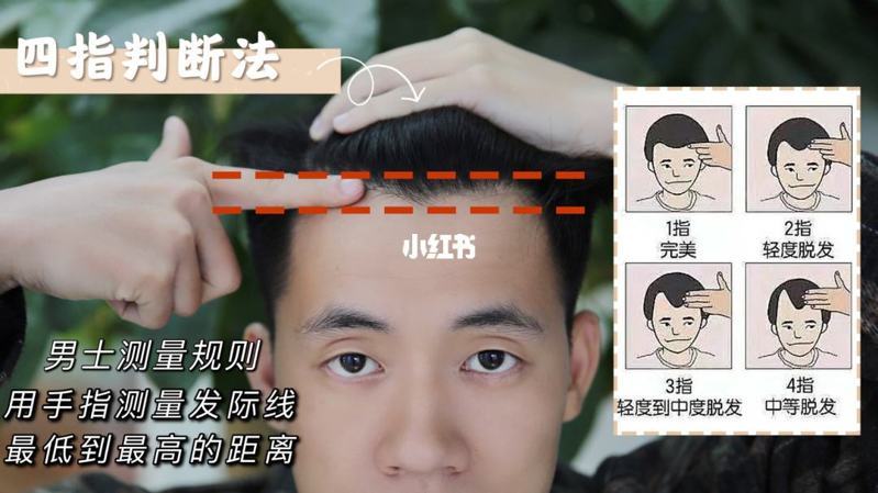 发际线高怎么恢复