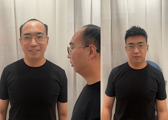 极客补发：脱发严重，戴假发坑不坑？