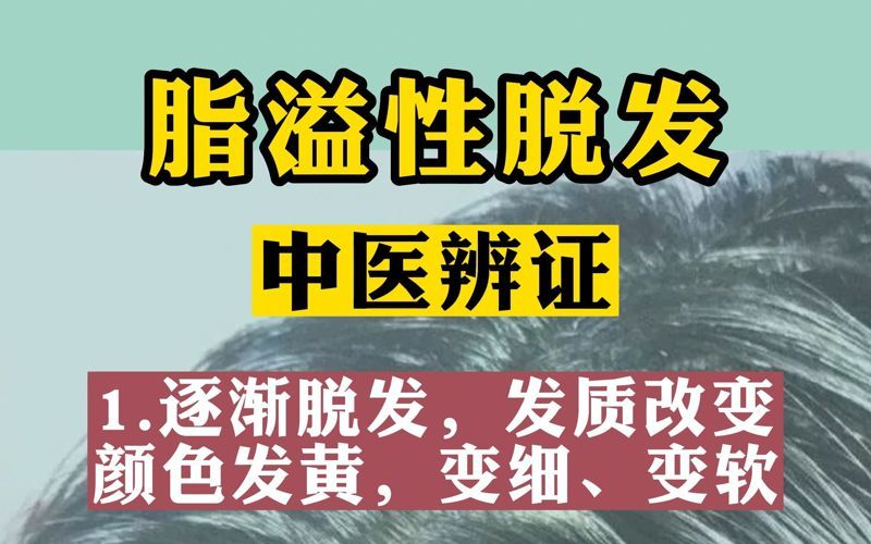 脂溢性脱发 脂溢性脱发