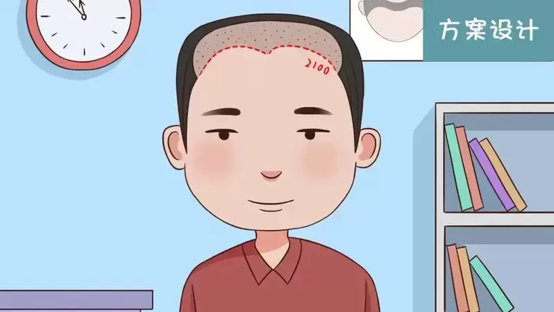 治疗脂溢性脱发的最好方法