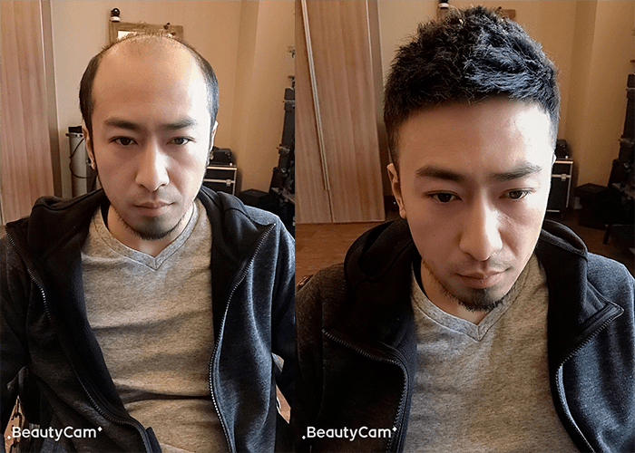 补发效果 补发效果
