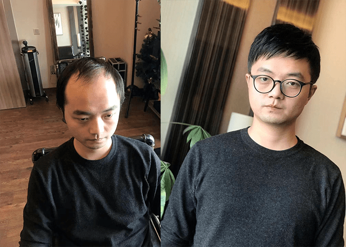 假发佩戴效果