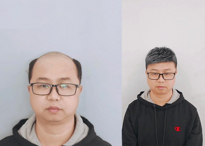 西安织发补发哪里好