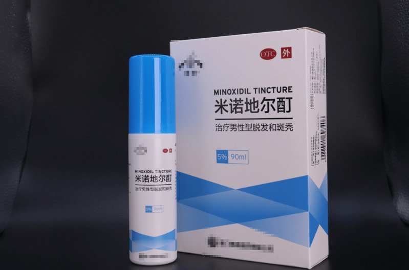 发际线后移是否能够彻底治好
