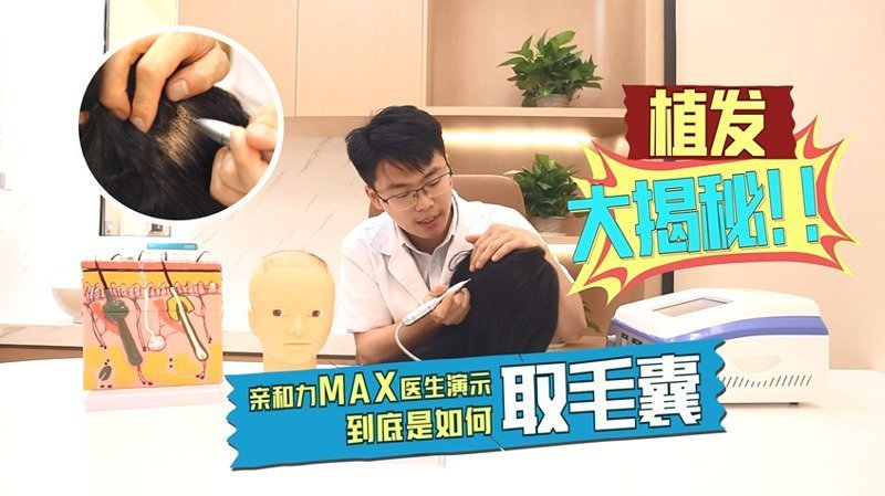 假发和植发哪个好？