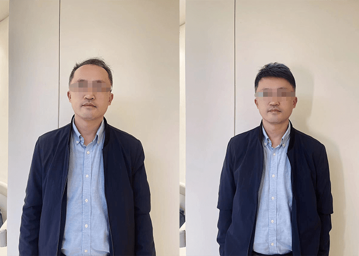 补发效果 补发效果