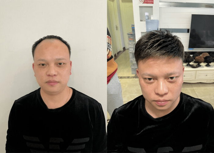 我现在比较熟练了佩戴很方便两三分钟就可以戴好 我现在比较熟练了佩戴很方便两三分钟就可以戴好