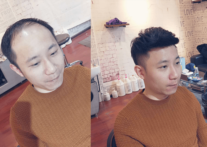 极客侠假发补发效果 极客侠假发补发效果