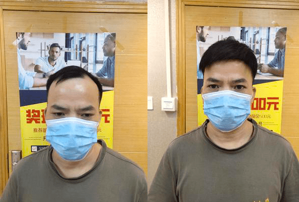 我不仅外表焕然一新,也重拾了生活的信心 我不仅外表焕然一新,也重拾了生活的信心