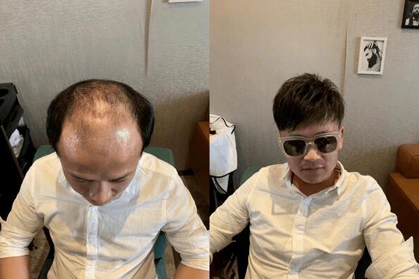 服务态度超级好,专业、细致、周到 服务态度超级好,专业、细致、周到