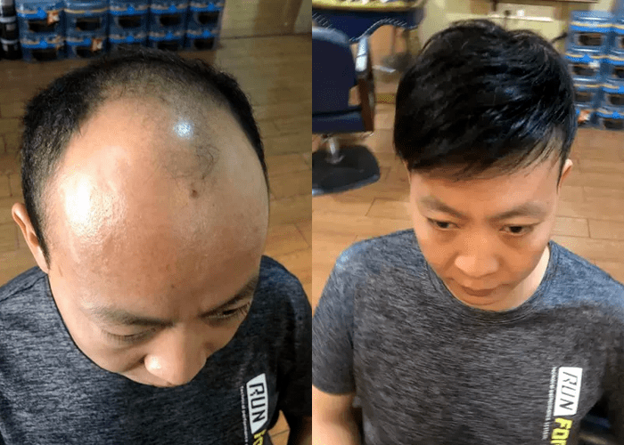假发的效果非常好 假发的效果非常好