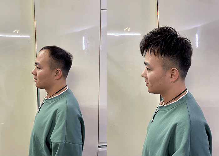 太原补发假发在什么地方？
