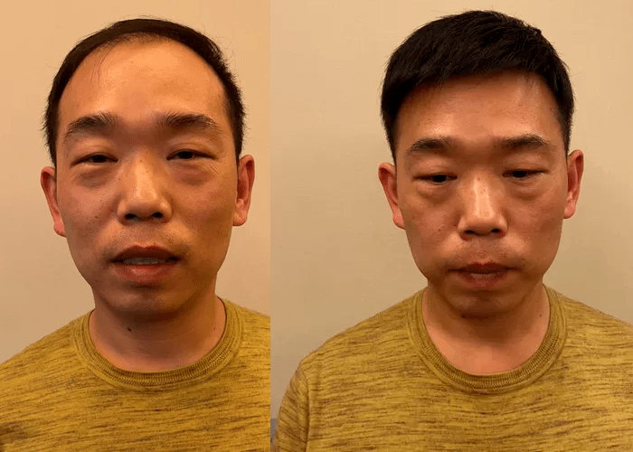 济南假发定制哪家最好？