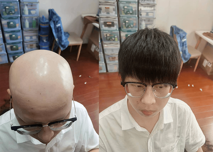 光头佩戴假发效果 光头佩戴假发效果