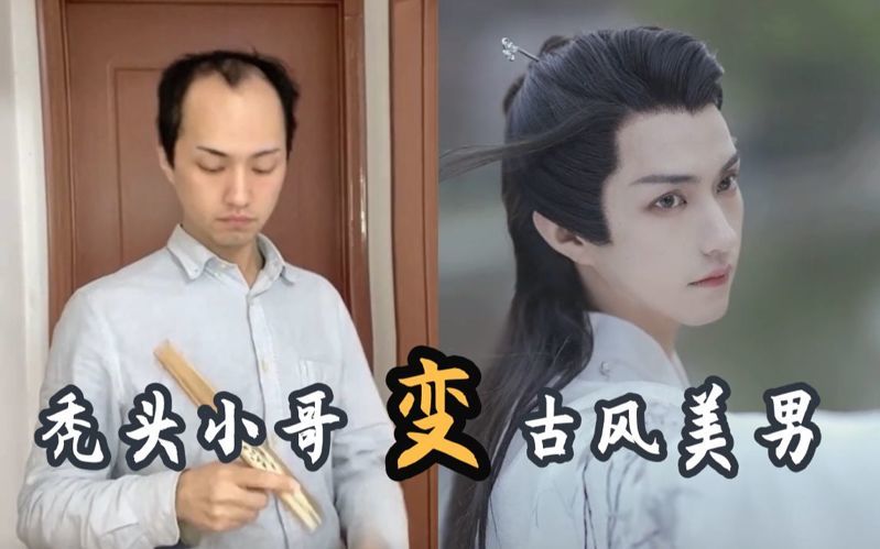 楚淇为什么会秃头？