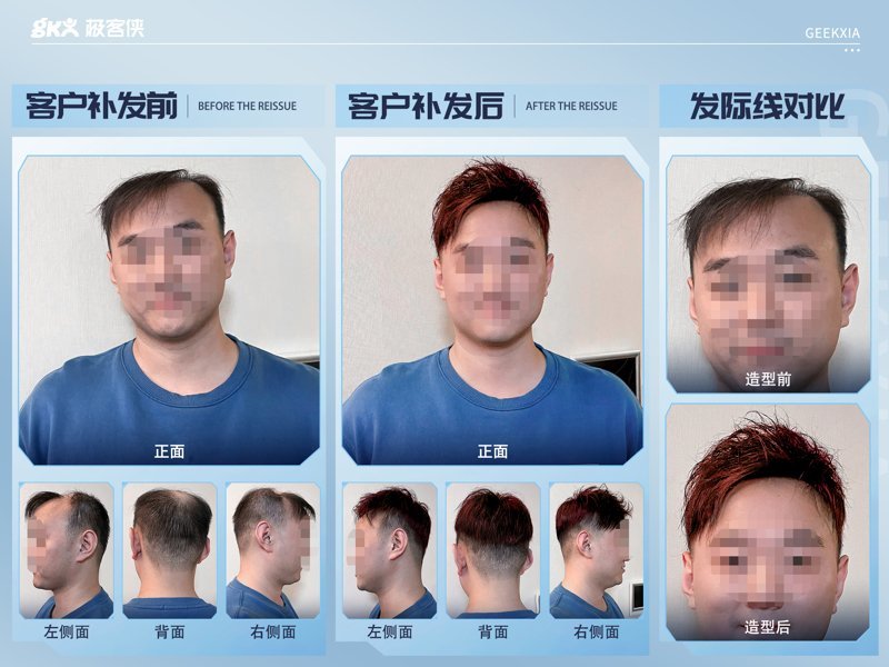 假发定制效果 假发定制效果