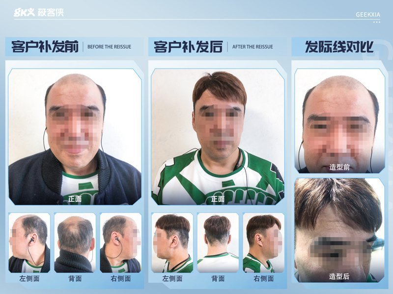 他们的假发质量真的很好，戴着特别舒服
