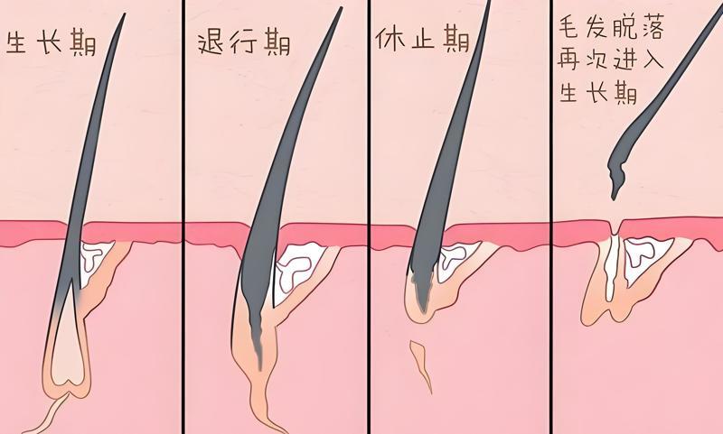 植发后毛囊会掉出来吗？