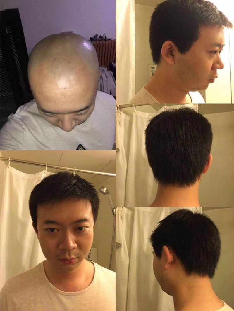 假发遮白发效果
