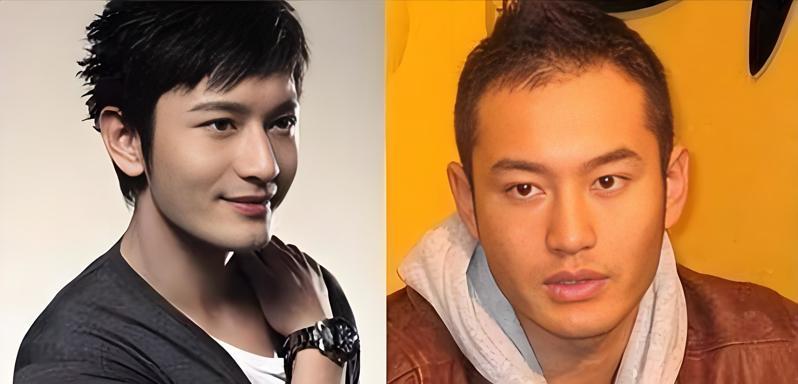 黄晓明治疗脱发的方法