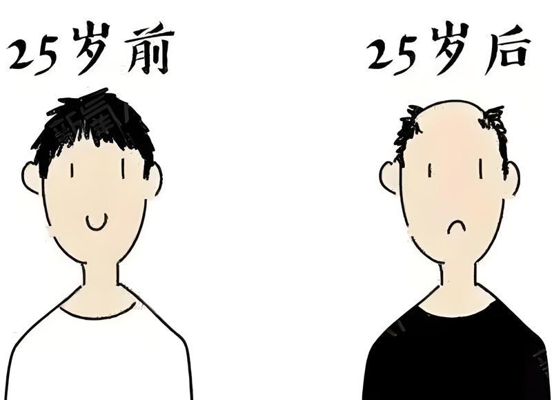季节脱发