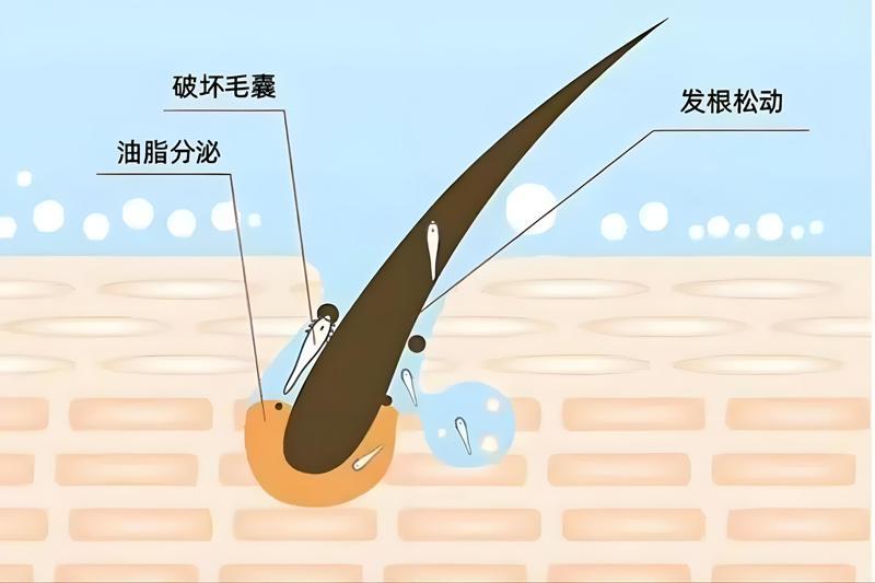 治疗方法