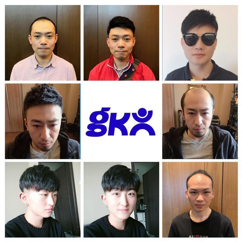 男士假发补发效果