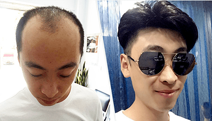 补发对比图 补发对比图