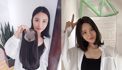 小A女士假发补发案例