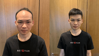 张先生男士补发案例