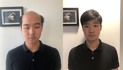 LEE先生男士补发案例