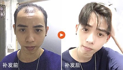 补发前后效果对比 补发前后效果对比