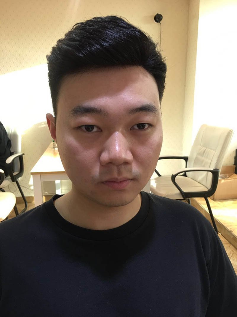 补发后效果图 补发后效果图
