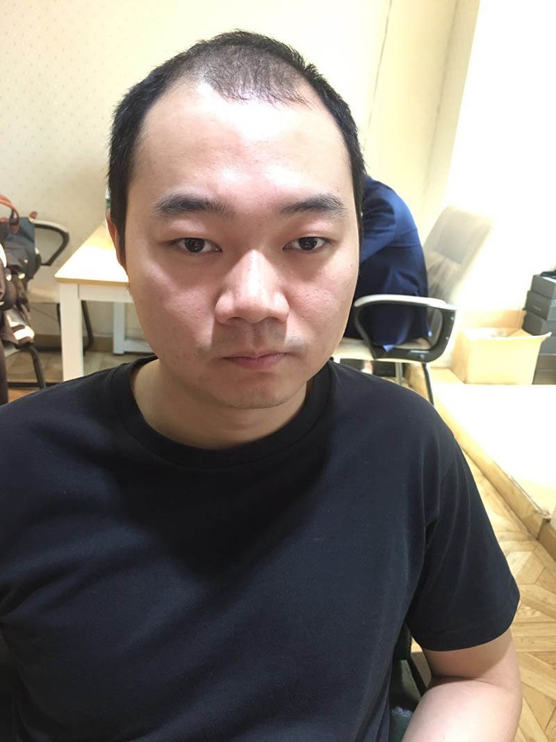 补发前效果图 补发前效果图