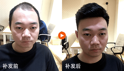 补发前后效果对比 补发前后效果对比