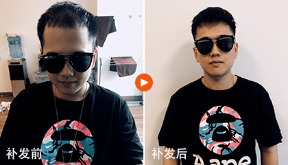 盖头顶的假发片怎么戴?(头顶假发片的正确佩戴方法) 盖头顶的假发片怎么戴?(头顶假发片的正确佩戴方法)