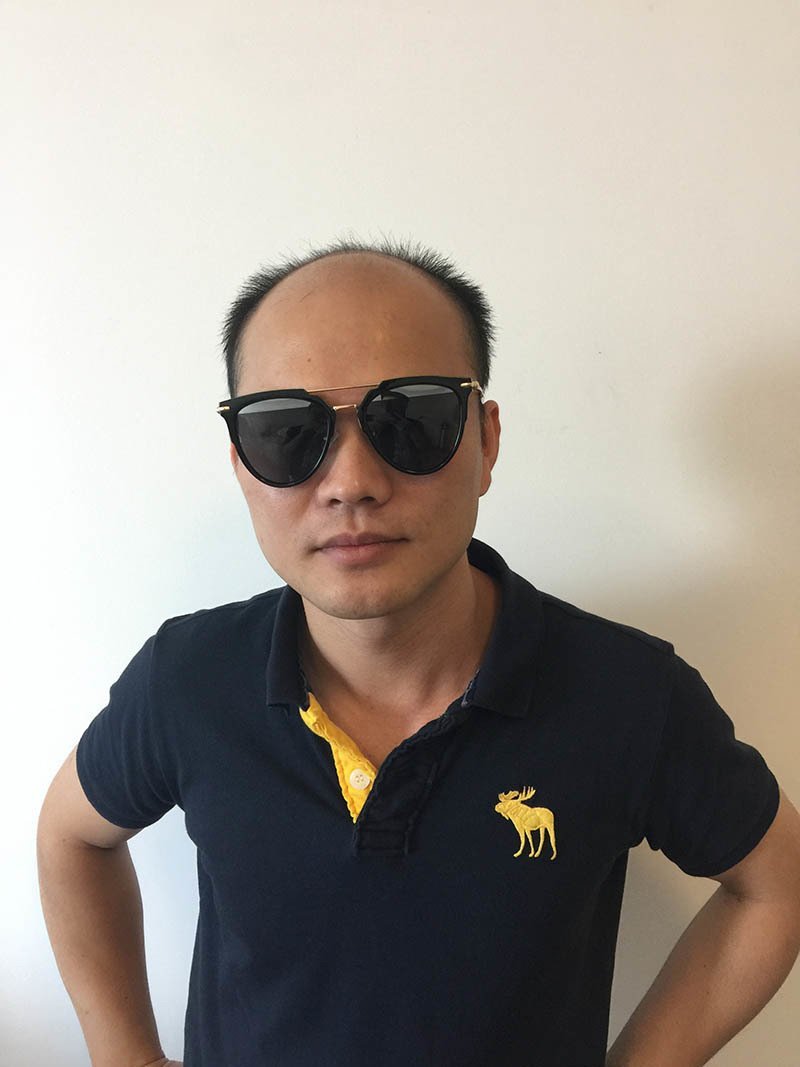 补发效果 补发效果
