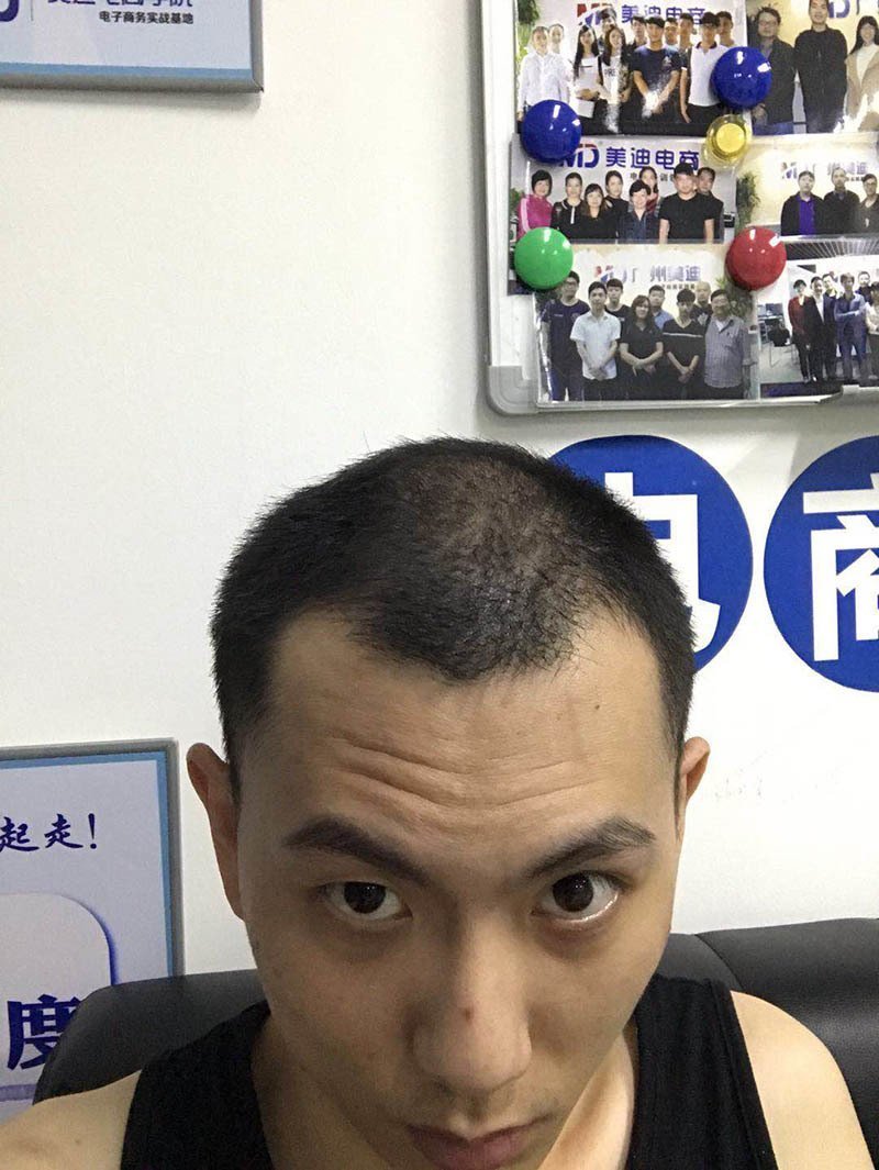 补发前