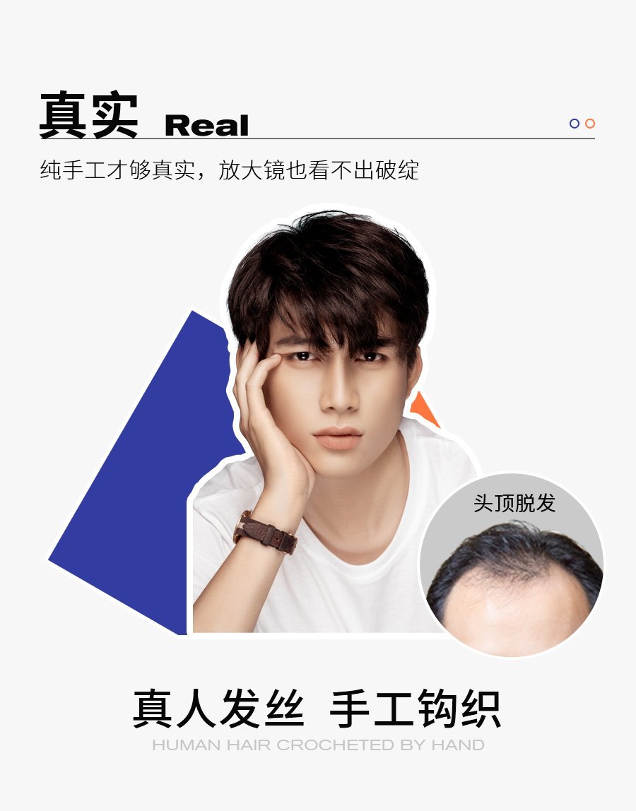 织发补发效果 织发补发效果