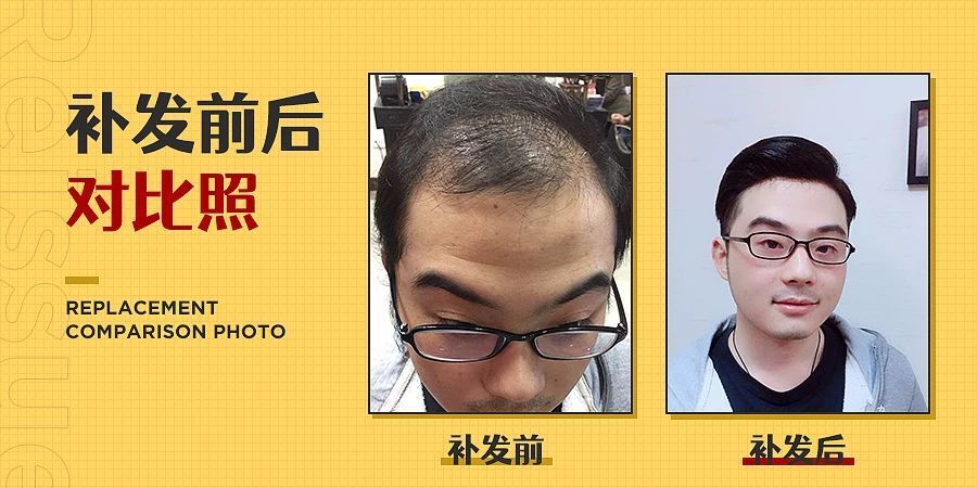 补发前后效果对比 补发前后效果对比