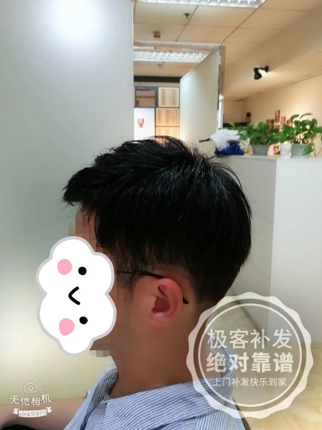 补发后侧面效果 补发后侧面效果