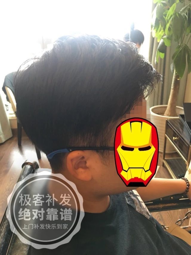 补发后侧面效果 补发后侧面效果