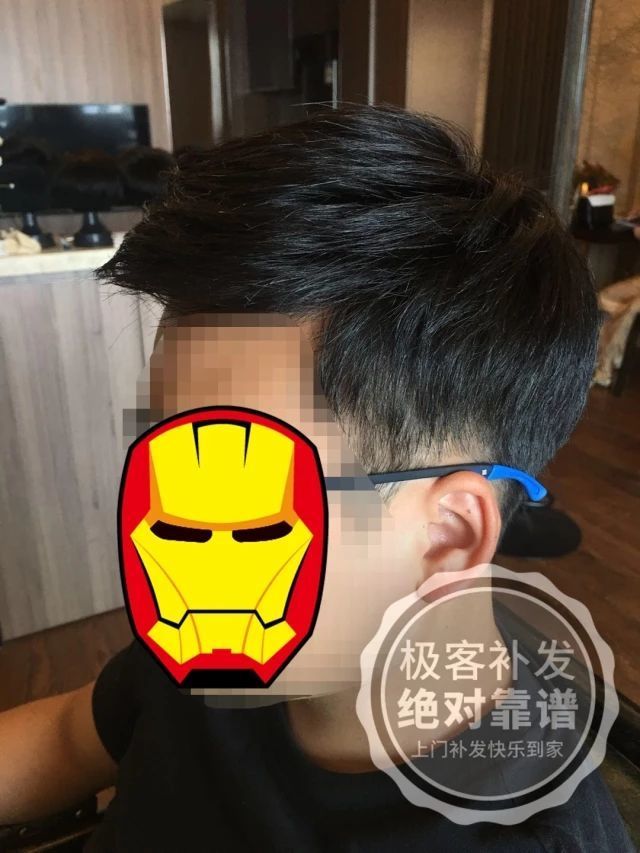 补发后侧面效果自然 补发后侧面效果自然