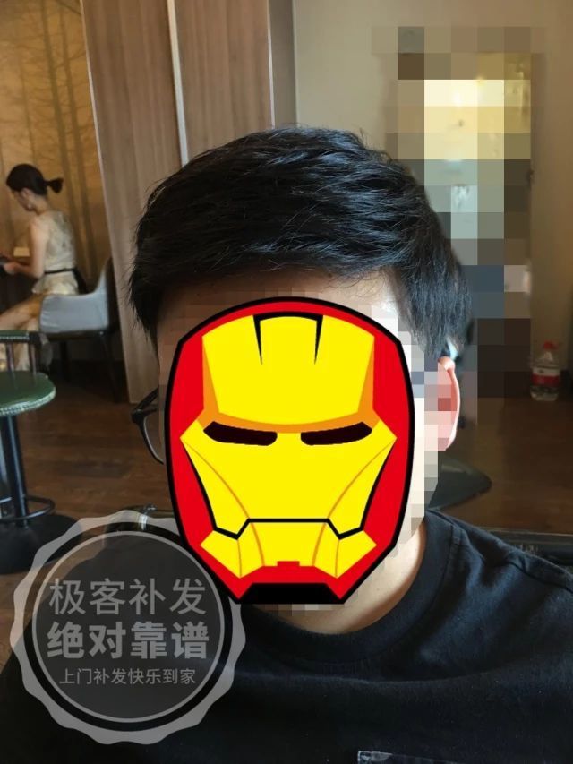 补发后正面帅气 补发后正面帅气