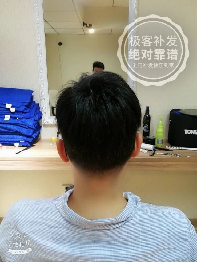 补发后背面效果 补发后背面效果