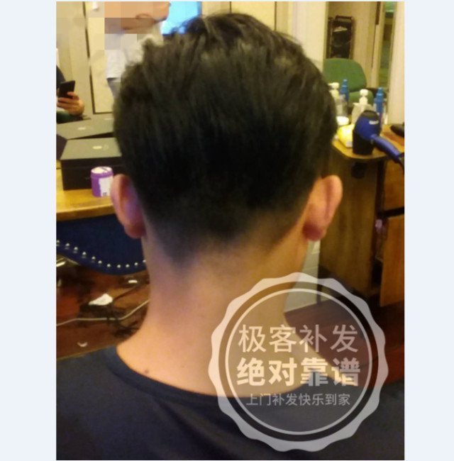 补发后背面效果 补发后背面效果