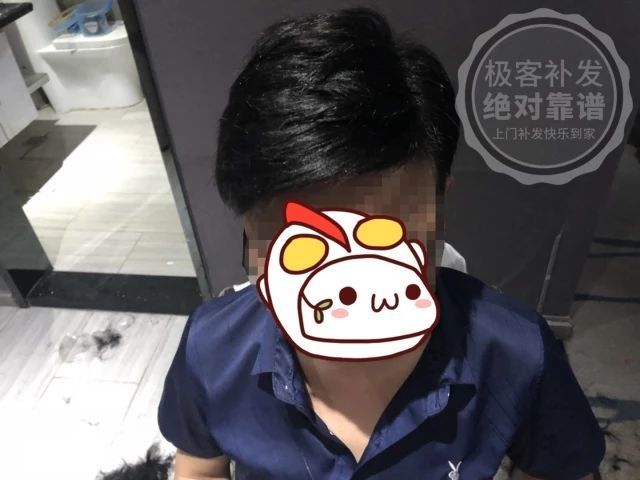 补发后正面效果 补发后正面效果