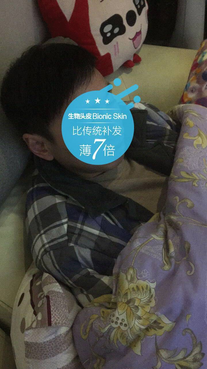 补发后效果 补发后效果