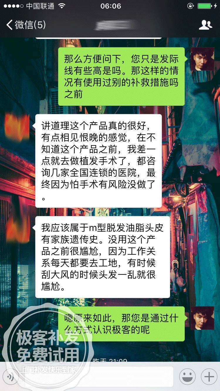 属于M型脱发 属于M型脱发